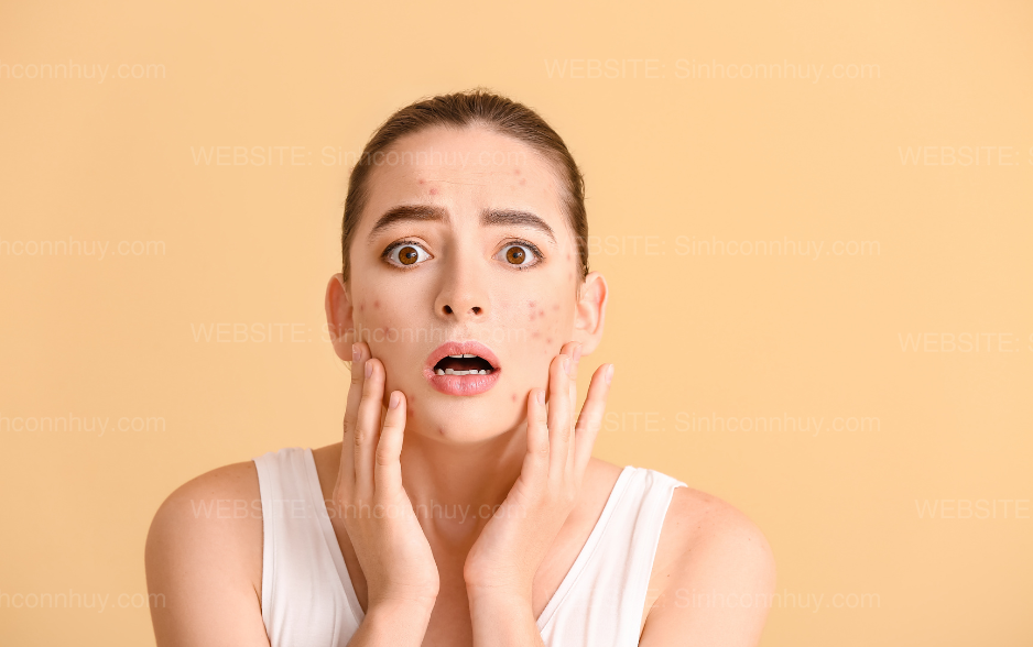 Da mặt xấu đi là dấu hiệu mang thai con trai