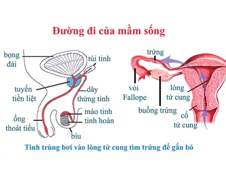 Hình ảnh tinh trùng Y hoặc X tiếp cận trứng để thụ tinh