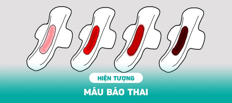 Máu báo thai, dấu hiệu có em bé sau 1 tuần quan hệ