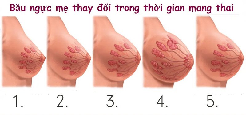 Thay đổi ngực là dấu hiệu khi thụ thai dễ nhận biét