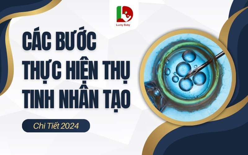 Các Bước Làm Thụ Tinh Nhân Tạo Quy Trình Chi Tiết 5 Giai Đoạn