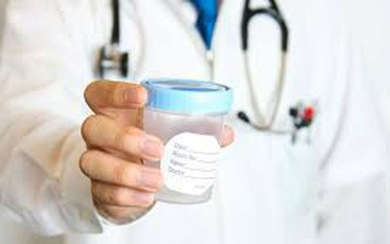 cách làm thụ tinh nhân tạo, xử lý mẫu tinh trùng