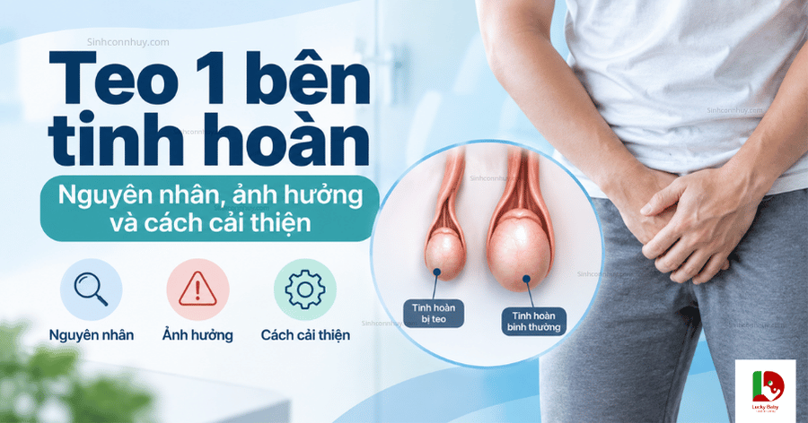 Teo 1 bên tinh hoàn: Nguyên nhân, ảnh hưởng và cách cải thiện